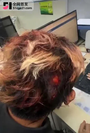 TFboys王源模仿者 王扁 摆摊卖烤串惨遭殴打4
