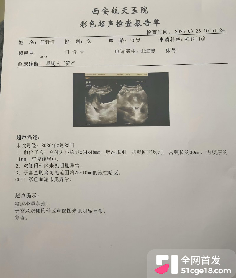 陕西安康职业技术学院 任紫楠不雅视频7
